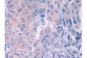 Immunohistochemistry (IHC) image for anti-Hemochromatosis Type 2 (Juvenile) (HFE2) (AA 234-416) antibody (ABIN1175334)