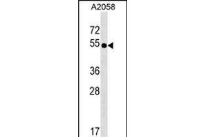 NHEDC2 Antibody (C-term) (ABIN1537363 and ABIN2849310) western blot analysis in  cell line lysates (35 μg/lane).