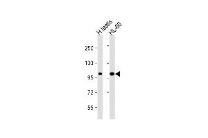 All lanes : Anti-SENP6 Antibody  at 1:1000 dilution Lane 1: human testis lysate Lane 2: HL-60 whole cell lysate Lysates/proteins at 20 μg per lane. (SENP6 Antikörper  (C-Term))