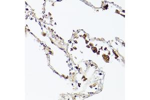 Immunohistochemistry (IHC) image for anti-Ferritin, Heavy Polypeptide 1 (FTH1) antibody (ABIN7267168)