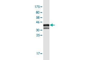 Western Blot detection against Immunogen (37. (UGT1A1 Antikörper  (AA 54-159))