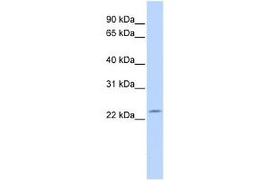 WB Suggested Anti-RP11-529I10. (DPCD Antikörper  (N-Term))