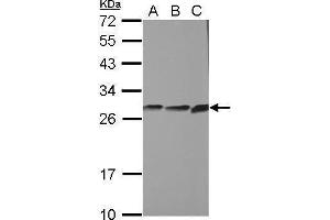 WB Image Sample (30 ug of whole cell lysate) A: PC-3 B: U87-MG C: SK-N-SH 12% SDS PAGE antibody diluted at 1:1000 (CYB5R2 Antikörper)