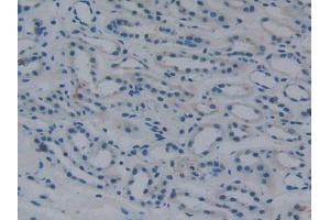 IHC-P analysis of Human Kidney Tissue, with DAB staining. (Fibrinogen beta Chain Antikörper  (AA 45-491))