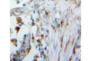 Used in DAB staining on fromalin fixed paraffin-embedded lung tissue (WFDC1 Antikörper  (AA 24-208))
