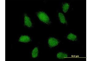 Immunofluorescence of purified MaxPab antibody to TRIM62 on HeLa cell. (TRIM62 Antikörper  (AA 1-475))
