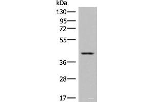 Western blot analysis of Human placenta tissue lysates using DHPS Polyclonal Antibody at dilution of 1:550 (DHPS Antikörper)