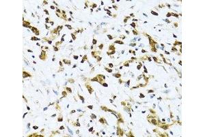 Immunohistochemistry (Paraffin-embedded Sections) (IHC (p)) image for anti-Integrin beta 3 Binding Protein (Beta3-Endonexin) (ITGB3BP) antibody (ABIN7258178)