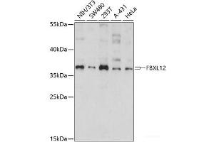 Western blot analysis of extracts of various cell lines using FBXL12 Polyclonal Antibody at dilution of 1:1000. (FBXL12 Antikörper)