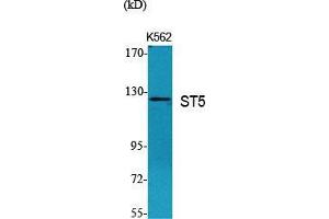 Western Blot (WB) analysis of specific cells using ST5 Polyclonal Antibody. (ST5 Antikörper  (Internal Region))