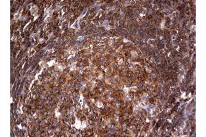 Image no. 2 for anti-Tuberous Sclerosis 1 (TSC1) (AA 836-1164) antibody (ABIN1491686) (TSC1 Antikörper  (AA 836-1164))