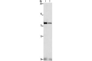 Western Blotting (WB) image for anti-Nuclear Factor (erythroid-Derived 2)-Like 1 (NFE2L1) antibody (ABIN2428493) (NFE2L1 Antikörper)