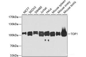 Western blot analysis of extracts of various cell lines using TOP1 Polyclonal Antibody at dilution of 1:1000. (Topoisomerase I Antikörper)