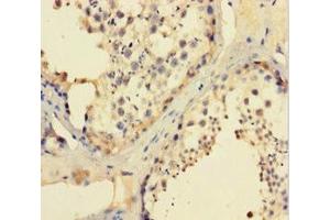 Immunohistochemistry of paraffin-embedded human testis tissue using ABIN7156529 at dilution of 1:100 (CCDC36 Antikörper  (AA 11-592))