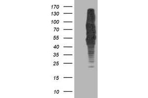 Western Blotting (WB) image for anti-Dihydrolipoamide Dehydrogenase (DLD) antibody (ABIN1497846) (DLD Antikörper)