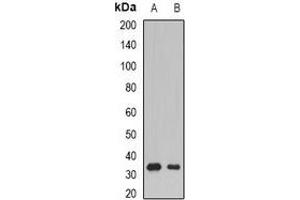 Western blot analysis of SSX5 expression in Raji (A), mouse skeletal muscle (B) whole cell lysates. (SSX5 Antikörper)