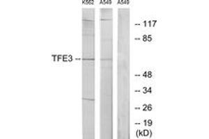 Western Blotting (WB) image for anti-Transcription Factor E3 (TFE3) (AA 101-150) antibody (ABIN2889417) (TFE3 Antikörper  (AA 101-150))