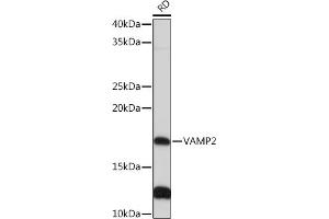 Western blot analysis of extracts of RD cells, using V Rabbit mAb (ABIN7271313) at 1:1000 dilution. (VAMP2 Antikörper)
