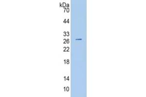 WB of Protein Standard: different control antibodies against Highly purified E. (PAPPA2 CLIA Kit)