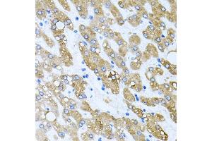 Immunohistochemistry of paraffin-embedded human liver damage using TOB2 antibody (ABIN6128831, ABIN6149377, ABIN6149378 and ABIN6223057) at dilution of 1:100 (40x lens). (TOB2 Antikörper  (AA 1-70))