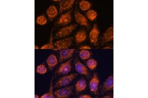 Immunofluorescence analysis of HeLa cells using MTMR9 antibody (ABIN6128253, ABIN6144163, ABIN6144164 and ABIN6217000) at dilution of 1:100. (MTMR9 Antikörper  (AA 1-250))