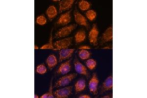 Immunofluorescence analysis of HeLa cells using MTMR9 antibody (ABIN6128253, ABIN6144163, ABIN6144164 and ABIN6217000) at dilution of 1:100. (MTMR9 Antikörper  (AA 1-250))