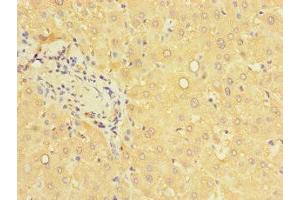 Immunohistochemistry (IHC) image for anti-Pterin-4 alpha-Carbinolamine Dehydratase/dimerization Cofactor of Hepatocyte Nuclear Factor 1 alpha (PCBD1) (AA 2-104) antibody (ABIN7166614)