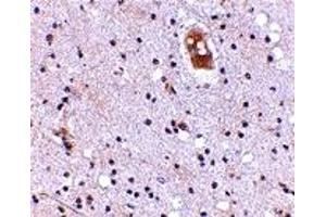Immunohistochemistry (IHC) image for anti-Transmembrane Channel-Like 8 (TMC8) (Middle Region) antibody (ABIN1030928) (TMC8 Antikörper  (Middle Region))