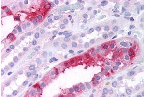 Immunohistochemistry (IHC) image for anti-serum/glucocorticoid Regulated Kinase Family, Member 3 (SGK3) (N-Term) antibody (ABIN1049327)