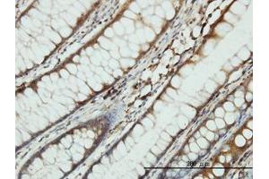 Image no. 2 for anti-Serine--tRNA Ligase, Cytoplasmic-Like (AA 1-515) antibody (ABIN598916) (Serine--tRNA Ligase, Cytoplasmic-Like (AA 1-515) Antikörper)