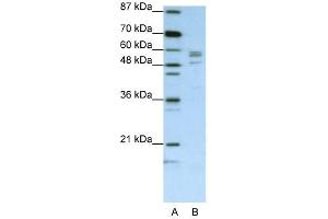 SARS antibody used at 1.