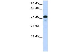WB Suggested Anti-SFTPB Antibody Titration:  0. (SFTPB Antikörper  (Middle Region))