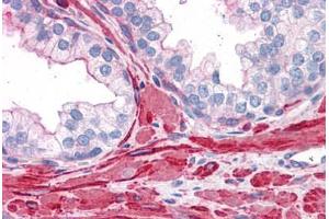 Human Prostate: Formalin-Fixed, Paraffin-Embedded (FFPE)