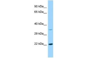 Host: Rabbit Target Name: KDELR2 Sample Type: RPMI-8226 Whole Cell lysates Antibody Dilution: 1. (KDELR2 Antikörper  (Middle Region))