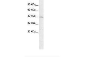 Image no. 1 for anti-Paired Box 3 (PAX3) (AA 164-213) antibody (ABIN202433) (Paired Box 3 Antikörper  (AA 164-213))