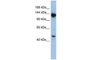 NRD1 antibody used at 1 ug/ml to detect target protein. (NRD1 Antikörper)