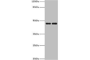 Western blot All lanes: Paired box protein Pax-6 antibody at 1 μg/mL Lane 1: Mouse stomach tissue Lane 2: Mouse eye tissue Secondary Goat polyclonal to rabbit IgG at 1/10000 dilution Predicted band size: 47, 49 kDa Observed band size: 47 kDa (PAX6 Antikörper  (AA 1-300))