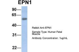 Host: Rabbit Target Name: EPN1 Sample Type: Human Fetal Muscle Antibody Dilution: 1. (Epsin 1 Antikörper  (C-Term))
