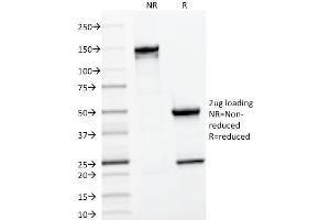 SDS-PAGE (SDS) image for anti-CD22 Molecule (CD22) (AA 52-178) antibody (ABIN6941121)