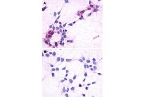 Immunocytochemistry (ICC) staining of HEK293 human embryonic kidney cells transfected (A) or untransfected (B) with GPR44. (Prostaglandin D2 Receptor 2 (PTGDR2) (3rd Extracellular Domain) Antikörper)