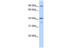 OAS1 antibody used at 0. (OAS1 Antikörper  (Middle Region))