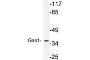Western blot (WB) analysis of Gas1 antibody in extracts from MCF-7 cells. (GAS1 Antikörper)