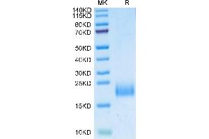 SDS-PAGE (SDS) image for Plasminogen Activator, Urokinase Receptor (PLAUR) (AA 23-114) protein (His tag) (ABIN7275403)