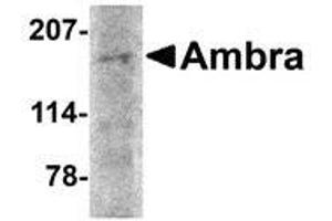 Western blot analysis of Ambra1 in rat brain tissue lysate with AP30048PU-N Ambra1 antibody at 2 μg/ml. (AMBRA1 Antikörper  (N-Term))