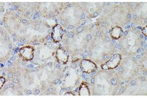 Immunohistochemistry of paraffin-embedded Rat kidney using NDUFAB1 Polyclonal Antibody at dilution of 1:100 (40x lens). (NDUFAB1 Antikörper)