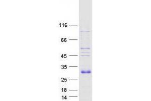 Western Blotting (WB) image for Vascular Endothelial Growth Factor B (VEGFB) protein (Myc-DYKDDDDK Tag) (ABIN2735224)