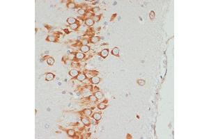 Immunohistochemistry of paraffin-embedded rat brain using Phospho-VASP-S157 antibody (ABIN6135335, ABIN6136286, ABIN6136287 and ABIN6225657) at dilution of 1:100 (40x lens). (VASP Antikörper  (pSer157))