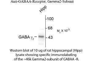 Western blot of GABAA Receptor γ2 Antibody Western Blot of Rabbit anti-GABAA Receptor γ2 Antibody. (GABRG2 Antikörper  (Cytoplasmic Loop))