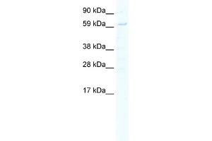WB Suggested Anti-STAT1 Antibody Titration:  5. (STAT1 Antikörper  (N-Term))