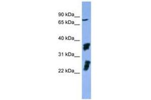Image no. 1 for anti-Fibroblast Growth Factor Receptor 2 (FGFR2) (AA 508-557) antibody (ABIN6746746) (FGFR2 Antikörper  (AA 508-557))